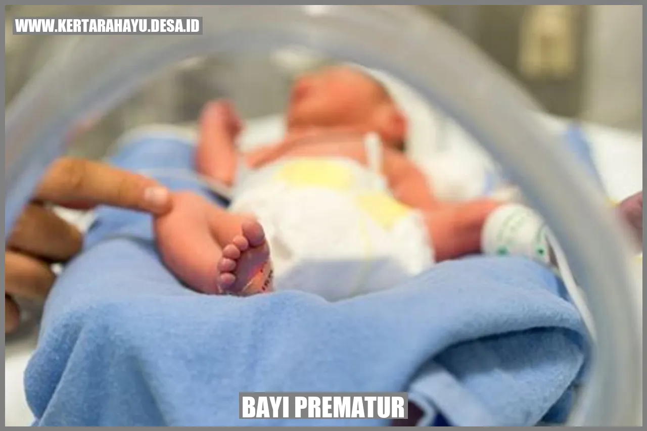 Bayi Prematur